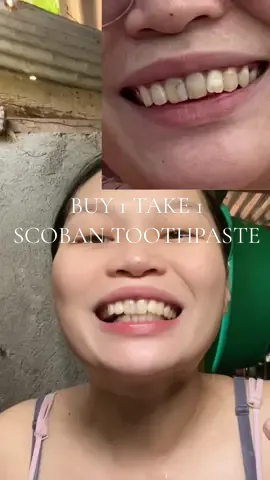 Honest review sa toothpaste na to‼️ #scobantoothpaste #scoban #teethwhitening #toothpaste 