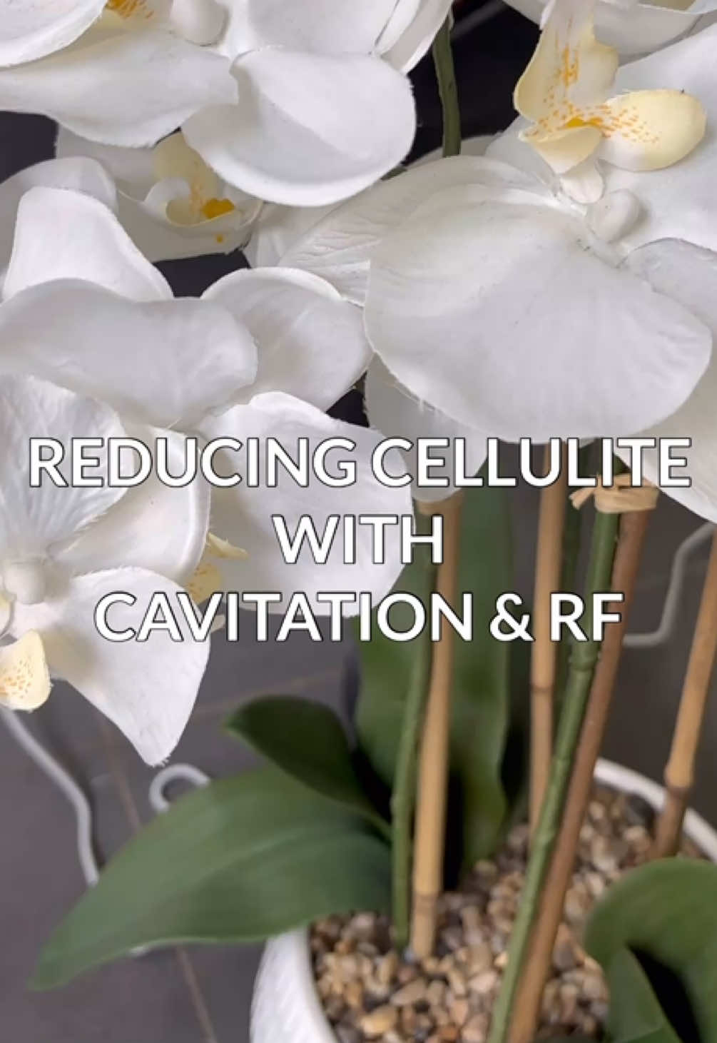 Bye bye cellulite!  Cavitation + RF = smoother, tighter, and more confident skin. Watch the magic happen!  #fyp #cellulitereduction #cellulite #cavitation #beauty 