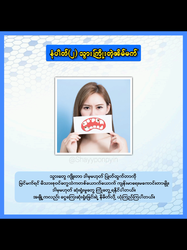 ကံနိမ့်ခါနီးမက်တတ်သော အိမ်မက်နိမိတ်(၈)မျိုး #နိမိတ် #အိမ်မက် #ကံဆိုးခါနီးမက်တတ်သောအိမ်မက်၈မျိုး #knowledge 