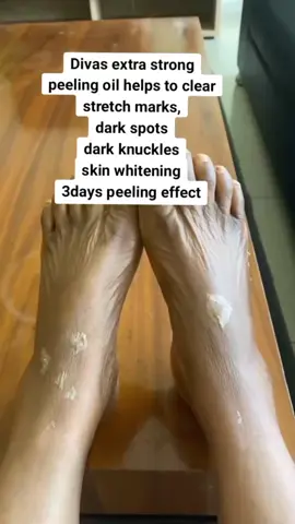 woo！#skin #skincare #fyp #beauty 