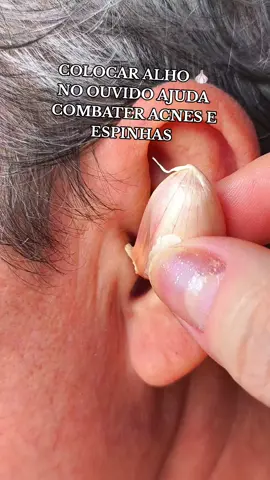benefícios do alho 🧄 para sua saúde, antifúngico, antibacteriana, combate acnes e espinhas  #dicasdapatricia #receitanatural 