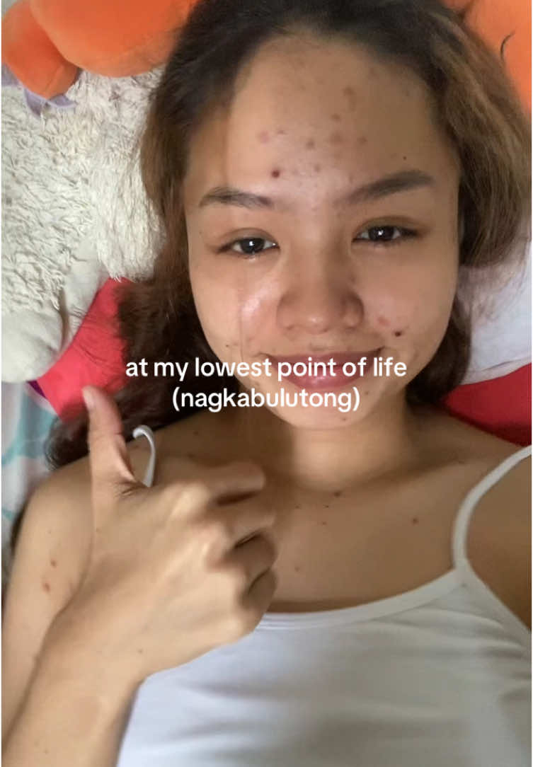 suggest pantanggal ng marks huhu #chickenfox #fyppppppppppppppppppppppp 