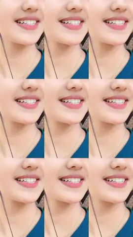 #সাপোর্ট_করলে_সাপোর্ট_পাবে #foryou #fyp #trending #foryoupage #viralvideo 