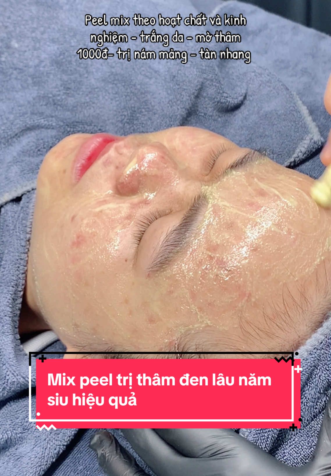 Mix peel theo hoatchat và kinh nghiệm của Hoa nè . Bảo sao phải học hoatchat  kĩ là vậy đó mấy bà. #spabacninh #xuhuongtiktok #spa #duocmypham #dmp #duocmyphamchinhhang #daotaohocvien #daotaohocvienchuyennghiep #daotaospa #daynghespa 
