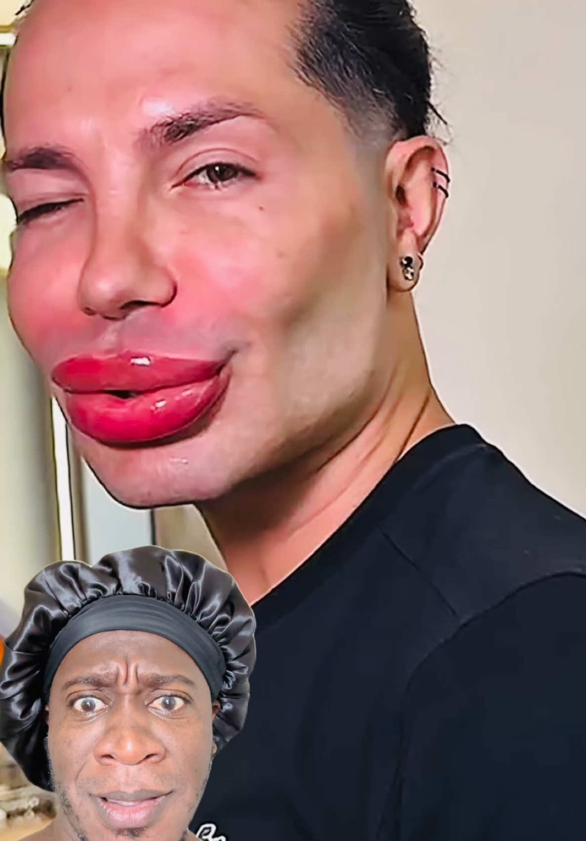 SE PUSE LA BOCA COMO UN CULØ DE VACA 🐄 