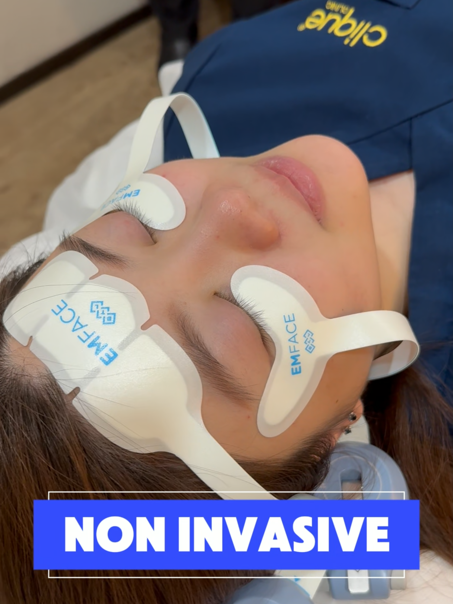 👀 Wrinkles? Puffiness? Droopy eyes? Say goodbye to tired-looking eyes! ✨ Introducing EMFACE EYE – the latest innovation at Clique Clinic to lift, smooth, and refresh your eye area without needles or downtime. Let your eyes shine bright again! 💫 #EMFACE #EYEAMREADY #EMFACEEYE #BrightEyes #NonSurgicalLift #CliqueClinic