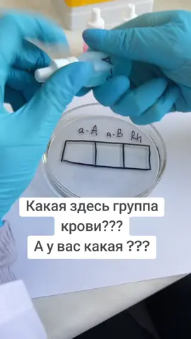 #blood #bloodgroup  #laboratory  #medicina 