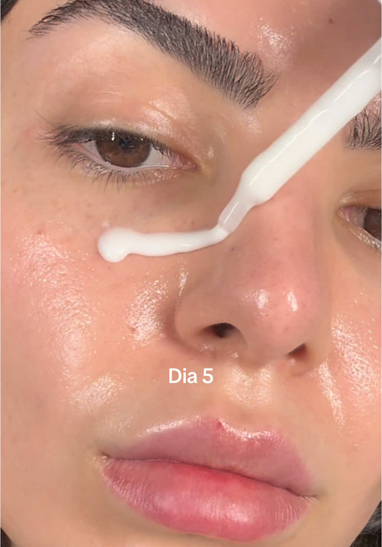 O melhor sérum que já usei para clarear todos os tipos de manchas e iluminar a pele!!! O Vinoperfect é um sérum super potente e 62x mais eficaz que a Vitamina C… eu não vivo sem! @Caudalie  #skincare #manchas #darkspots #pelesaudavel #pele #piel #skincareroutine #skintok #dicasdebeleza #dicas #rotinadeskincare 