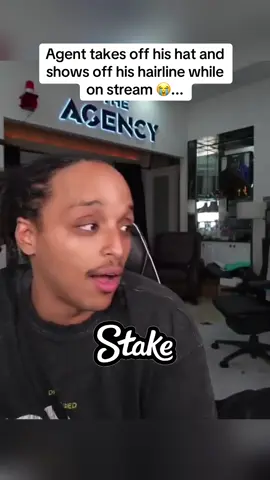Agent takes off his hat and shows off his hairline while on stream 😭... #agent #hairline #stream 