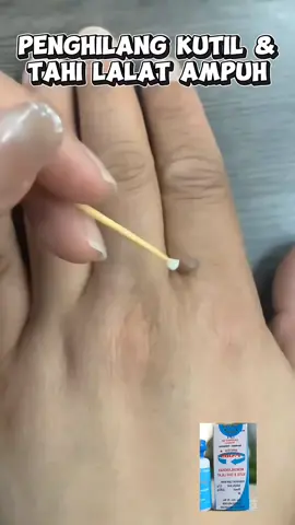 Swiss Paris lotion penghilang tahi lalat dan kutil ampuh. #swissparis #swissparislotion #penghilangkutil #tahilalat 