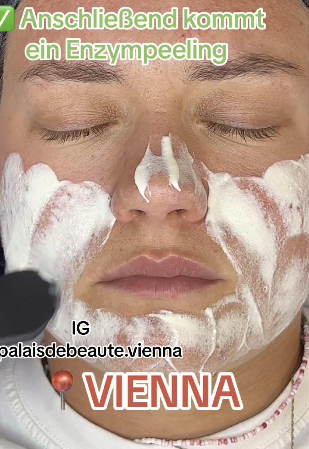 In einer Gesichtsreinigung sind enthalten: Cleanser Double cleanser Toner Dampfreinigung Enzympeeling Manuelles entfernen von Mitessern Tiefenreinigung Vakuum Reinigung  Ultraschall Reinigung  Mini Microneedling (gegen Poren auf der Nase + 15€ extra!!) Heiltonerde Maske/Anti Akne Maske Serum (Feuchtigkeit, Anti Akne, Anti Aging) Gesichtsmassage Feuchtigkeitsmaske Boosting cream 75€ Für einen Termin DM auf insta❣️ #skin #skincare #skincareroutine #skincaretips #facial #facialtreatment #facialmask #niacinamide #vitaminc #retinol #aha #bha #pimple #acne #acnetreatment #acneskin #pimples #ausreinigung #tiefenreinigung #facialwien #facialvienna #reinigungwien #kosmetik#kosmetikwien #tiefenreinigungwien #pickel #haut #mitesser #vienna #viennacity #viennagirl #wien #wien🇦🇹 