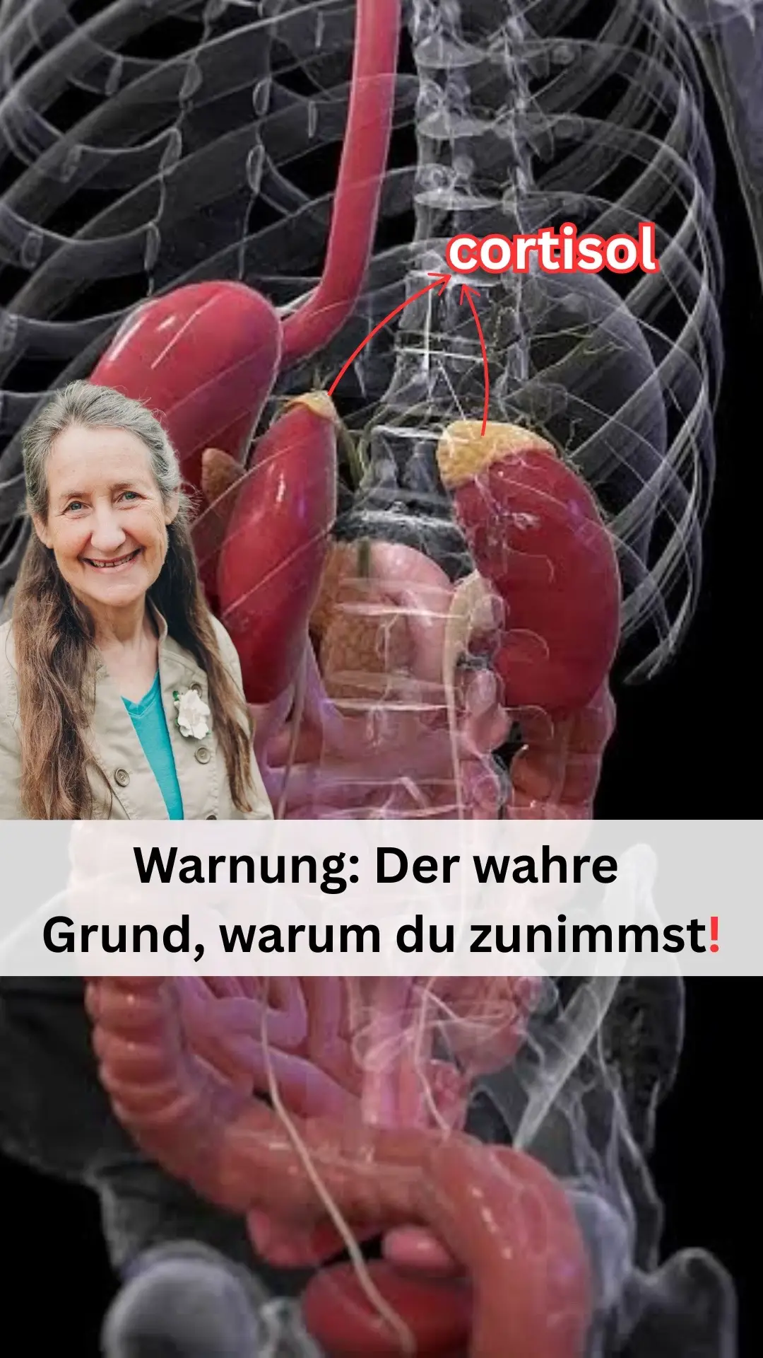Vielleicht ist dein Bauchumfang nur auf Blähungen zurückzuführen und sehr wahrscheinlich liegt die wahre Ursache an einem erhöhten Cortisolspiegel, dem sogenannten Stresshormon. Zu viel Cortisol führt nicht nur zur Fettansammlung am Bauch, sondern lässt auch dein Gesicht geschwollen wirken, begünstigt Hautunreinheiten und sorgt dafür, dass du dich ständig müde und energielos fühlst selbst nach ausreichend Schlaf oder einem Mittagsschlaf. Wenn du nach einer natürlichen Methode suchst, um deinen Cortisolspiegel zu senken, habe ich einen ganz einfachen Tipp für dich: Immer wenn ich mich aufgebläht, müde oder energielos ohne erkennbaren Grund fühle, nehme ich einfach eine kleine Dosis reines Shilajit und schon nach kurzer Zeit spüre ich einen deutlichen Unterschied. Shilajit ist eine natürliche Substanz, der ich seit Jahren vertraue. Es ist zuckerfrei, glutenfrei, GMO-frei, vegan und reich an Nährstoffen wie Vitamin C, Folsäure, Vitamin D sowie vielen essenziellen Mineralien allesamt hilfreich zur Hormonregulation und natürlichen Cortisolreduktion. Wenn du dich oft müde, aufgebläht oder ausgelaugt fühlst, kann ich dir nur empfehlen, es selbst auszuprobieren. Klicke auf den Link in meinem Profil und sichere dir die reinste Form von Shilajit direkt vom Forschungsteam von Wellnessnest! #fyp #santé #shilajit #nourriture 