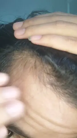 amunisi  combo buat mengatasi masalah kerontokan rambut @cave.id 