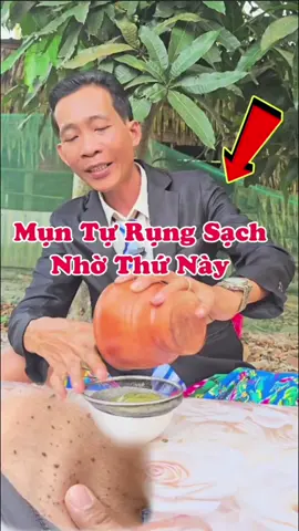 Mụn Tự Rụng Sạch Khỏi Tốn Một Xu Khi Làm Cách Này #nhipsongmoi #mẹovặt #nsm 