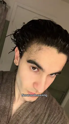 Giving away some of my hairline, type 1 to enter the giveaway #hairline 