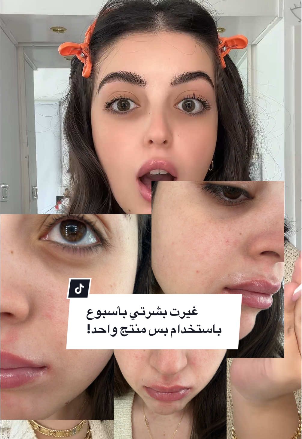 اذا مش عاجبتك بشرتك، غيريها😌😉 @dr.althea_ar  