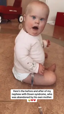 💔😭 #downsyndrome #baby #labor #mom #mother #daughter #sister