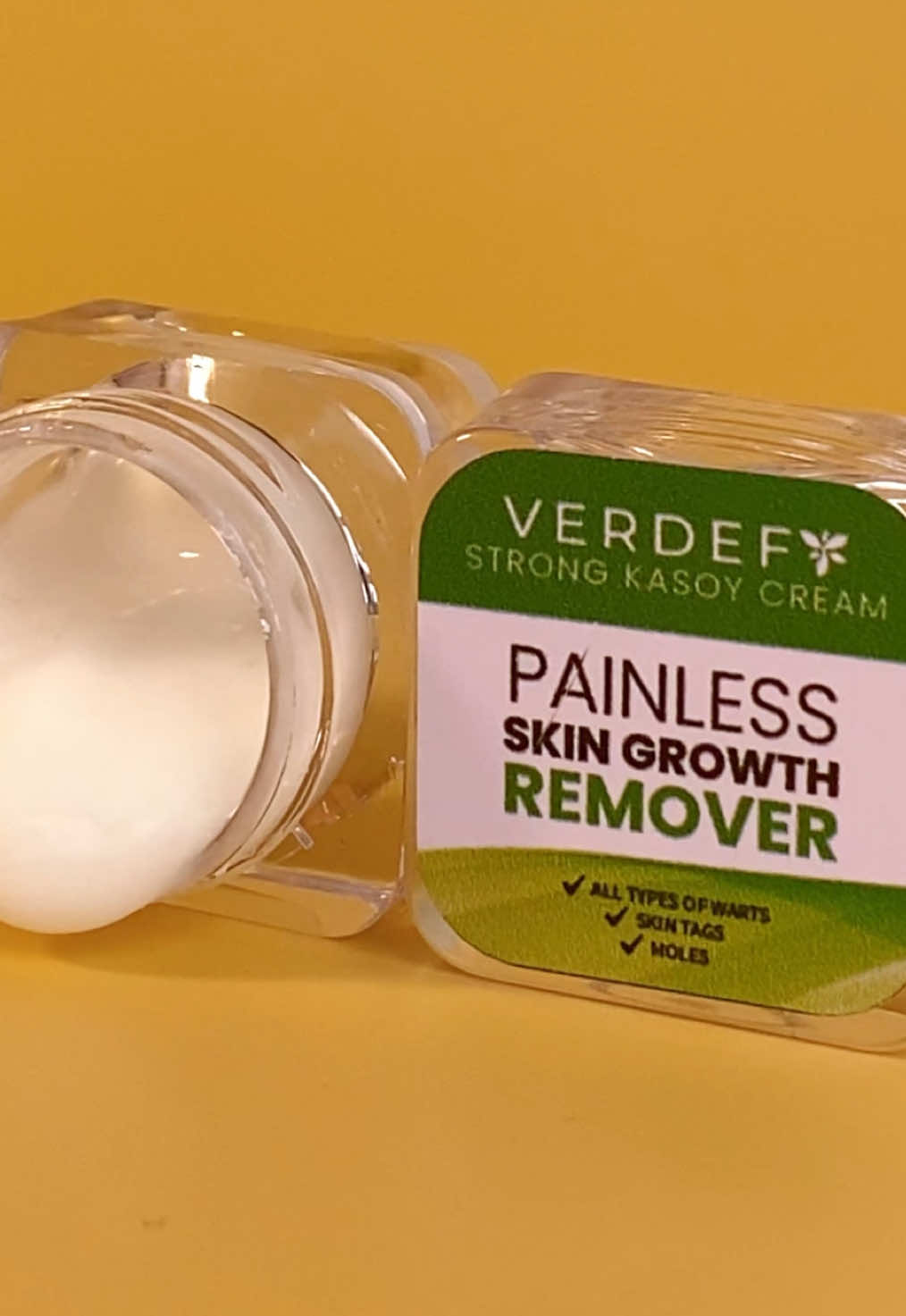 Say goodbye to skin concerns! 💪✨  A strong Kasoy Cream that works on all types of warts, skin tags, and moles! 😍 #KasoyCream #WartRemoval #SkinTagRemover #MoleRemoval #SkinCarePH #NaturalRemedy #TikTokFindsPH #SkincareSolution #HealthySkin #Verdefy #KasoyCream #VerdefyKasoyCream 