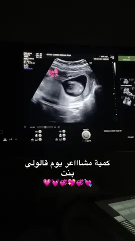 الحمدلله على عطايا الرحمن🙂♥️♥️ #CapCut #دعوة_طيبه #يارب_فوضت_امري_اليك #يارب_دعوتك_فأستجب_لي_دعائي #ججبرات📮 #الله_يقومكن_بالسلامه_حوامل🥺💓 #حوامل_الشهر_التاسع 