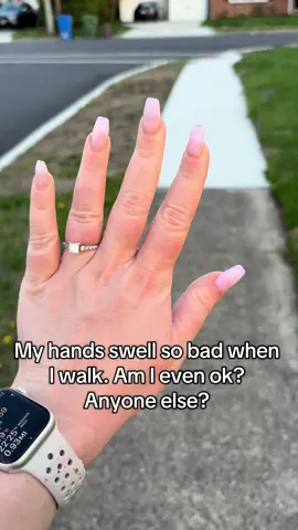 Why do my hands swell so bad when I walk y’all?! #walking #walk #10ksteps #swelling #hands #diamonds 