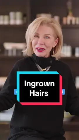 Can you sugar ingrown hairs? #bodysugaring #sugaring #sugaringhairremoval #sugarwax #esthetician #sugarwaxtutorial #BeautyTok #howtosugarwax #alexandriaprofessional #sugarwaxing #ingrownhair 