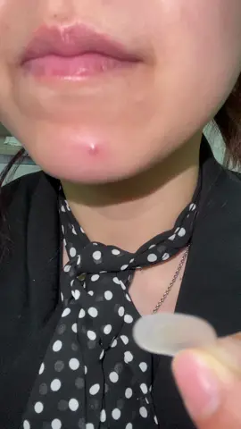 The best product, the best experience#rowmshi #acnepatch #acnepatchviral #rowmshiacnemicroneedle #microneedling #pimples #jerawat #acnetreatment 
