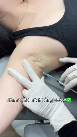 Bà nào, ông nào đang bị hôi nách, mồ hôi nách thì xử lý ngay đi nhá!#Tiêmfullface #filler #botox #moibaby #tiembap #tiemthaiduong #xuhuong #capcut #trending #trend #trihoinach 
