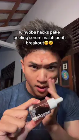 mesti liat sampe akhir😠 #fyp #peelingsolution #skincare #g2gpeelingsolution