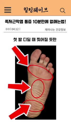 #족저근막염 통증 10분만에 없애는 법 첫 발 디딜 때 찢어 질 듯한 발바닥 통증으로 힘드시죠? 단 10분이면 통증을 잡을 수 있습니다 그 전에 이 고양이가 너무 귀엽다고 생각하시면 구독과 좋아요 눌러주세요 족저근막염은 발바닥 근막에 염증이 생겨서 생기는 대표적인 통증질환인데요 보통 평발 혹은 요족 또는 오래 서있거나, 많이 걷는 등 발바닥이 근막이 혹사 당하면 생깁니다 또는, 너무 신발을 신거나해서 종아리 근육이 짧아지면 순환이 되지 못해 많이 생긴다고 하네요 지금 부터 족저근막염 통증 10분만에 잡는 마사지법 알려드릴게요 첫째 : 테니스공이나 물병으로 발바닥을 천천히 굴려주세요. 이때 물병에 물을 넣고 얼려서 사용하면, 염증이 있는 발바닥에 시원하게 마사지가 가능합니다 둘째 : 종아리 스트레칭이 중요합니다 벽에 손을 짚고 종아리를 쭉 늘려주세요. 근막이 발바닥과 서로 연결되어 있어#발#ㅈ서 종아리 스트레칭이 매우 중요합니다 셋째 : 왼쪽 아래 구매링크 클릭해서 “리커버풋 마사지기”를 사용해 보세요 저주파가 발바닥 근육과 종아리를  마사지 하고 강화하여, 발바닥 아치를 세워 줍니다 이미 1000명 이상이 구입해서 평점이 4.8점 이상인 제품으로 믿고 구매하셔도 될듯해요 번거로운 마사지 필요 없이, 발에 채우고 버튼을 누르면 끝! 족저근막염 통증 10분만에 바로 잡을수 있습니다 댓글에 “전자책”이라고 적어주시면 10만원 상당의 족저근막염 관리법 책을 무료로 보내드립니다