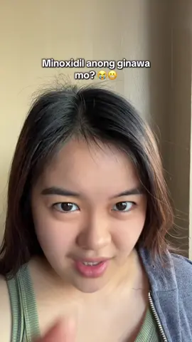 Hairfall or panot? No problem minoxidil gotchu  #minoxidil #minoxidilresult 