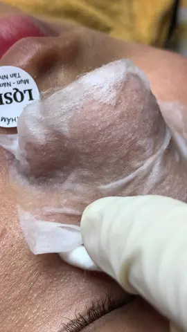 Mê#chamsocdamun#chamsocdaseo#chamsocda#chamsocdamun#chamsocdaseo#chamsocdanam#tanbinh#govap #Lequynh#Lqspa#hocnghespa  #chamsocda #lequynhspa #lequynhspahcm#vienthammylqspa#lqspabeautyacdemy