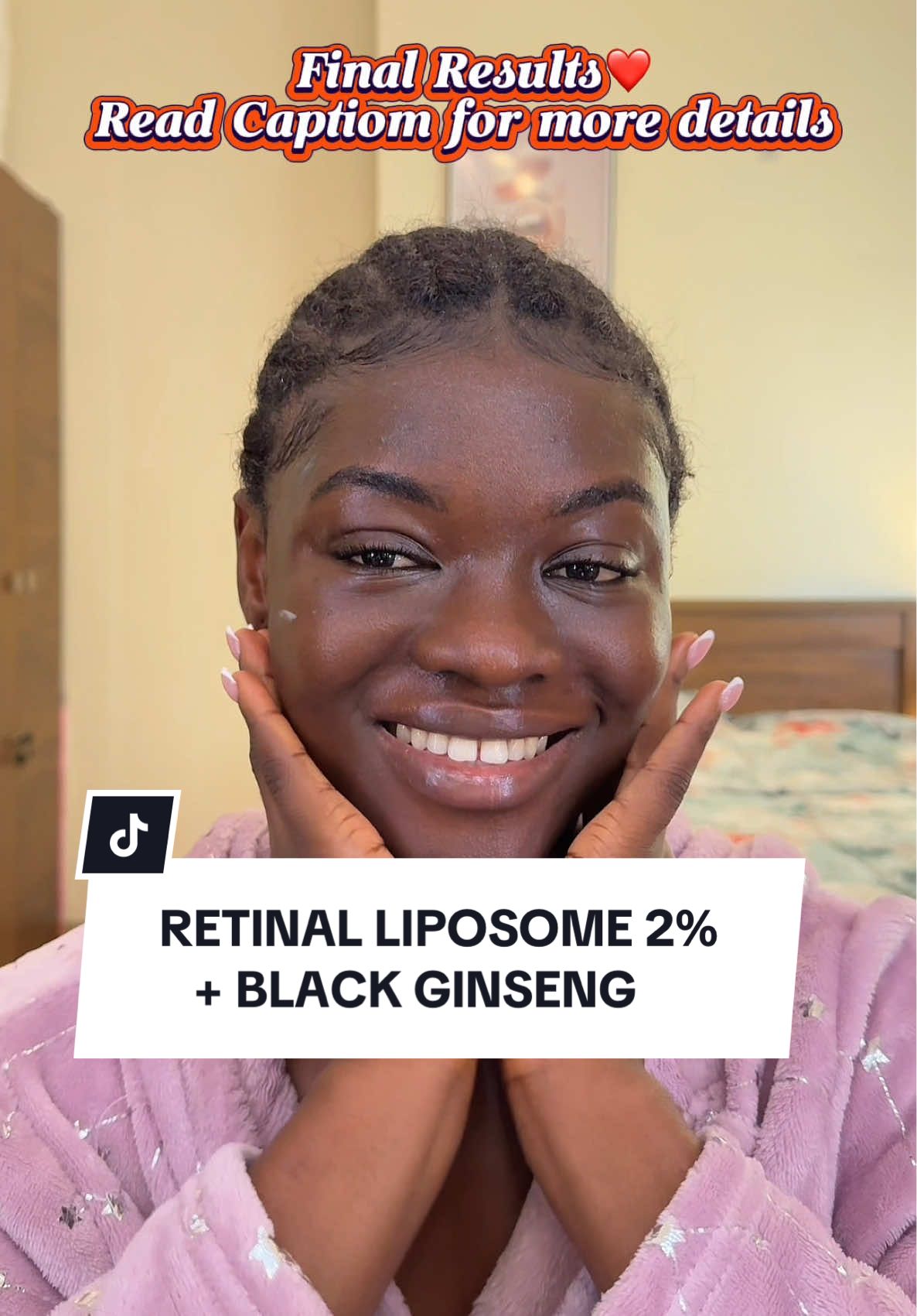 Tried @KSECRET GLOBAL  SEOUL 1988 SERUM RETINAL LIPOSOME 2% + BLACK GINSENG and the effects are amazing ❤️ You can get this on YesStyle, Amazon, Stylekorean & Stylevana . You can use my code “AWOVI10” on YesStyle to save some money.. #microinfluencers #pr #contentcreator #skincare #skintok #kbeauty #koreanskincare #skincareroutine #7days #rerinalserum #acneserum #poreserum #rednessserum #fypシviral 