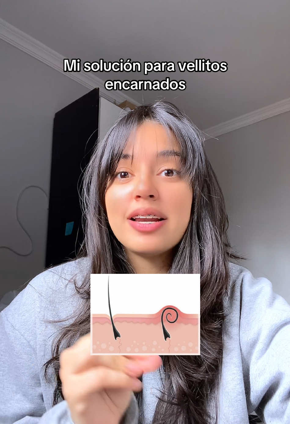 Algo más: 👀👇🏻 -Si esto te pasa muy constante, evita depilarte con cera porque si tus vellitos tienden a crecer mal o más débiles ellos no logran traspasar la capa de la piel, entonces quedan ahi adentro, ES POCO COMÚN pero si es algo que te pasa mucho y no es un vellito si no que son MUCHOS y justo estás utilizando cera, mejor suspenderla para intentar otro método de depilación (solo para ver y entender si lá cera era la causa) 🎀 . #autocuidado #tips #vellosenterrados #vellos #hack #autocuidadofeminino #pielsana #tipsforgirls #foliculite 