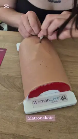 HOLA! Dejo este video para que vean como es la inserción de un implante anticonceptivo de 2 varillas 🥰  En el mercado puedes encontrar  2 tipos: JADELLE y LEVOPLANT 🌸🌸🌸🌸🌸 - Matronakote