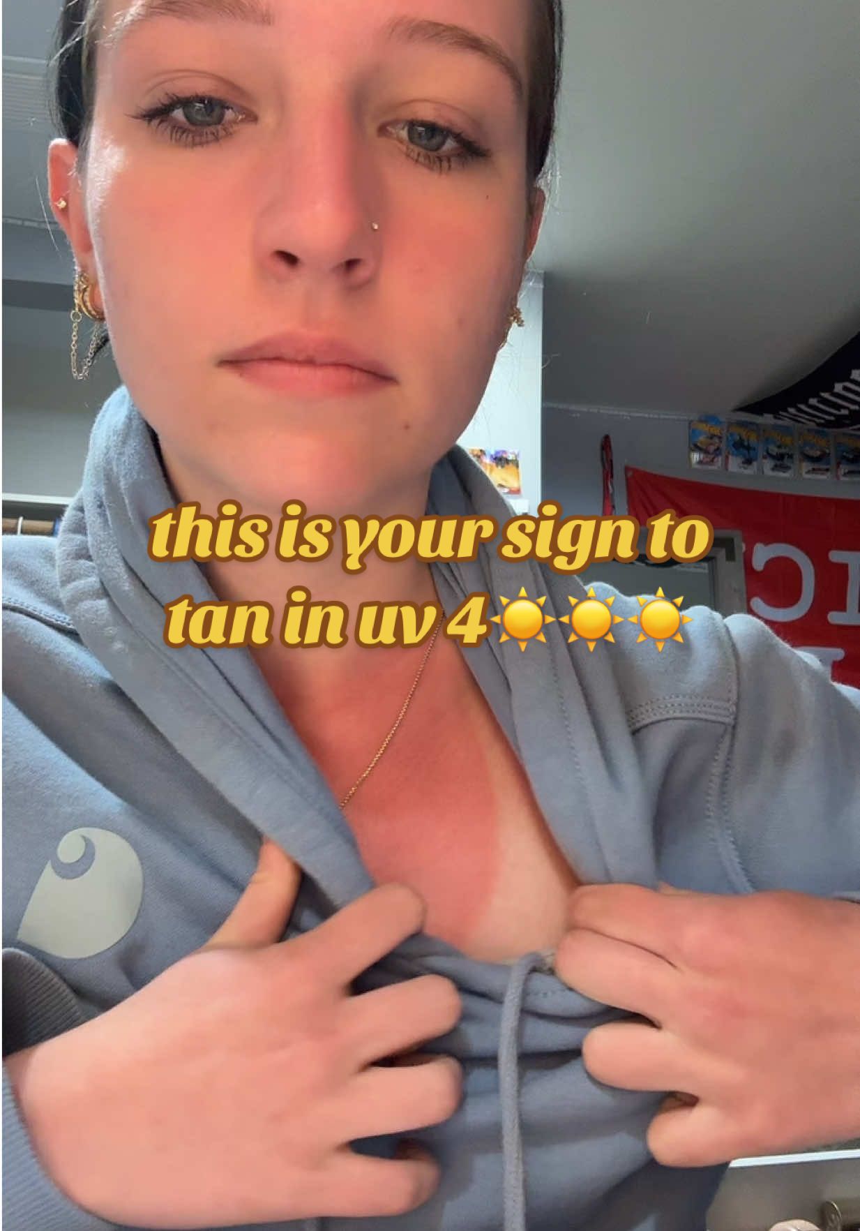 i am so sunburnt it hurts 😣 usually i don’t get burnt on my legs but it’s pretty bad on my legs (sorry im breathing so heavy im very sick so it’s hard for me to breath) #grwmroutine #fyp #sunburnt #tanning #tiktok #viral #uv4 #blowthisup 