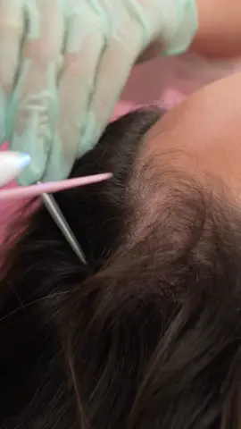 ASMR Hair Cracking (Pulling) & Ear Seeds Therapy | Tingles, Scalp Care Triggers & Deep Relaxation #asmrrealperson #scalpcare #scalcheck #earseeds #asmr #asmrrelax #ivybasmr #hairbrushing #hairpulling #haircracking #tingles #asmrtok #hairtok