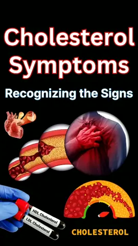 Cholesterol Symptoms - Recognizing The Signs #cholesterol #highcholesterol #ChestPain #Angina #arteries #Breath #Tiredness #Fatigue #heartattack #heartdisease #Swelling #Legs #Feet #edema #ankles #HeartPalpitations #heart #heartbeats #BloodPressure #HighBloodPressure #Hypertension #stroke #cardiovascular 