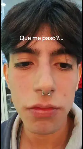 Que belleza ome Ig:Miguel_Remolina #paratii #fyp #belleza #cambiodelook #cambiofisico #brackets 