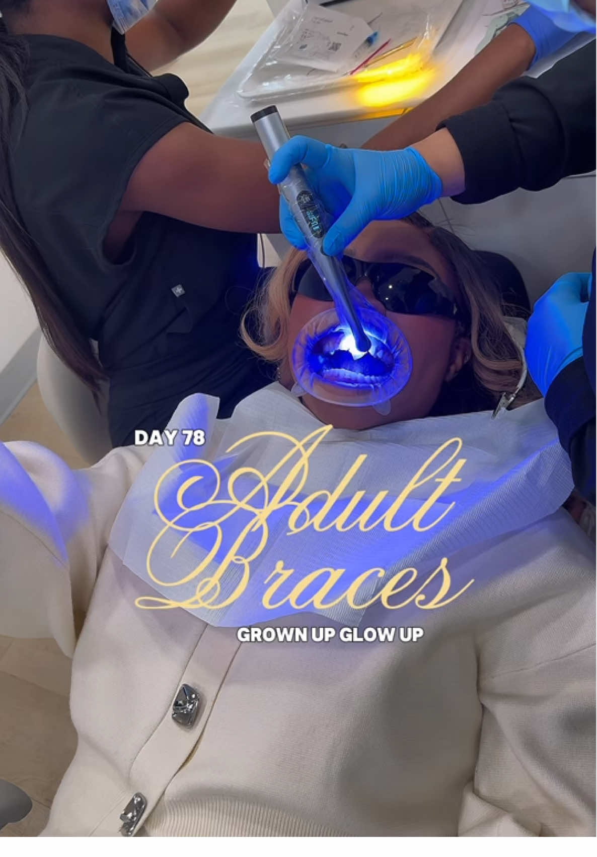 You’re never too old for a glow up! 🙂‍↔️ thank you @North Dallas Smiles excited for my new smile! #adultbraces #invisalign #orthodontics 