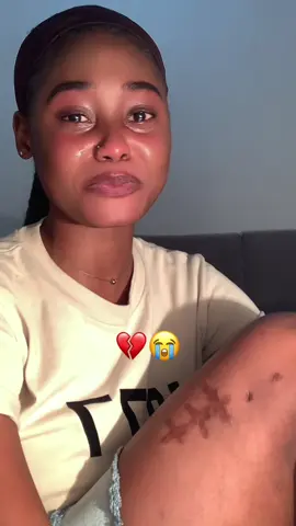 Cicatrizes não se curam 💔😭#trendtriste💔🥀 #palops🇦🇴🇲🇿🇸🇹🇨🇻🇬🇼 #atuação 