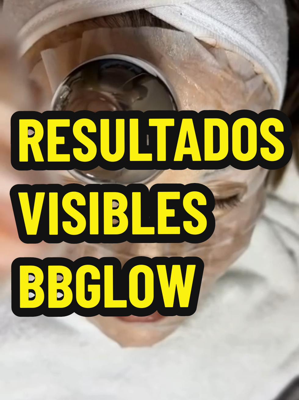Que esperas para rejuvenecer tu rostro con nosotros?🥰👀 Nos especializamos en varios procedimientos de belleza 😘👋🏻 #viral #fyp #ecu #ecuador #bbglowkorea #bbglowtreatment #viral_video 