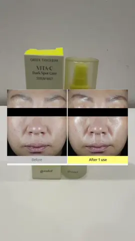 Thêm 1 loại serum dạng xịt cho các nàng nè #xitduong #serumdangxit #goodal #vitaminc #sangda 