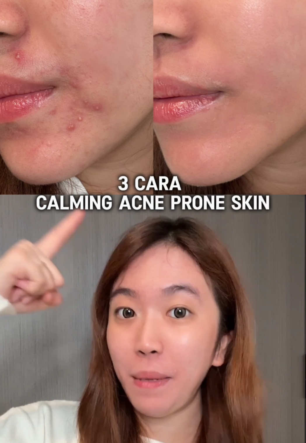 Cara calming acne prone skin! Salah satu tipsnya pakai @skin1004indonesia tea-trica soothing sun milk yang ada kandungan tea tree & centella! ✨💚 #skin #skin1004 