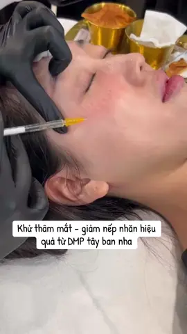 Tinh Chất Meso Trị Quầng Thâm,  👉Trẻ Hóa Mắt SkinTech RRS HA Eyes được chế tạo đặc biệt cho làn da lão hóa quanh mắt,  👉Tác dụng sinh hóa của axit Hyaluronic không liên kết ngang trên nếp nhăn được tăng cường bằng một giải pháp biorevitalisation cụ thể có chứa các vitamin, chất chống oxy hóa, vi tuần hoàn và pha trộn với các hoạt chất làm trắng. 👉Sản phẩm chăm sóc da này cần được thực hiện bởi các bác sĩ có nhiều năm kinh nghiệm và theo các bước chuẩn y khoa.  👉Hiệu quả có được sau khi tiêm và em đã trải nghiệm 🥰