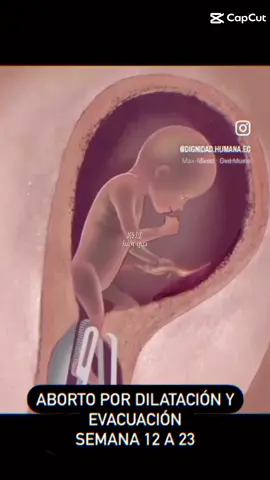 tsao con ng đáng sợ tới mức lại đi p.h.á t.h.a.i nếu k có chuyện đấy thì số con kp kiếp kumanthong rồi🖤#vica🐳 #thegioitamlinh #kuman #suri #viral #pheptrang #xyzbca #4tuoinha #conlaconcuame #kitty #chill #xhhhhhhhhhhhhhhhhhhhhhhhhhhhhhhhhhhhhhhhhhhhhhhhhhhhhhhhhhhhhhhhhhhhh #kumanthong❤️🙆‍♀️ #doll🚫 #vica🐳 #kumanthongg💞 #thailand🇹🇭 #xh 