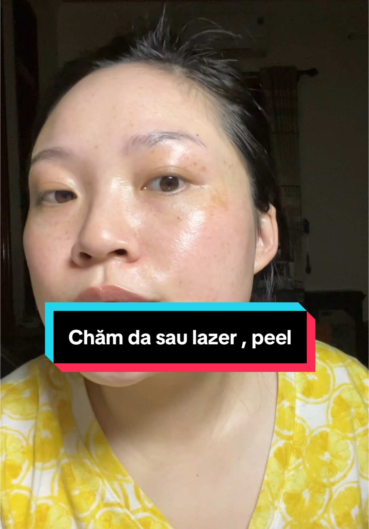 Nếu biết cách dưỡng thì da có thể duy trì hiệu quả khá lâu ạ #goclamdep #BeautyTok #skincare #peelda #peelcangbong #fyp 