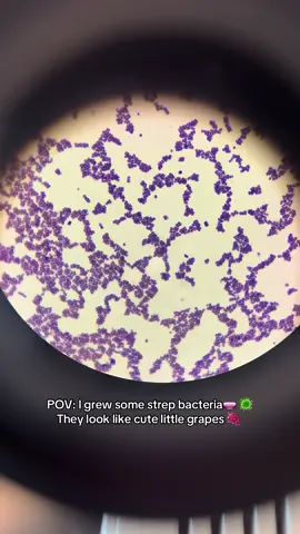 These babies grew out of a skin swab  #goodmorning #microbiology #lab #bacteria #microscope #strep #laboratory #Science #education #educational #fyp #fypシ #fypage #fypシ゚viral #fyppppppppppppppppppppppp 