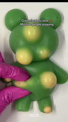 Cutestgteen bear pimple popping #asmr #fyp #satisfying #onthisday #DIY #icantlookaway #relax #viral #gummybear 