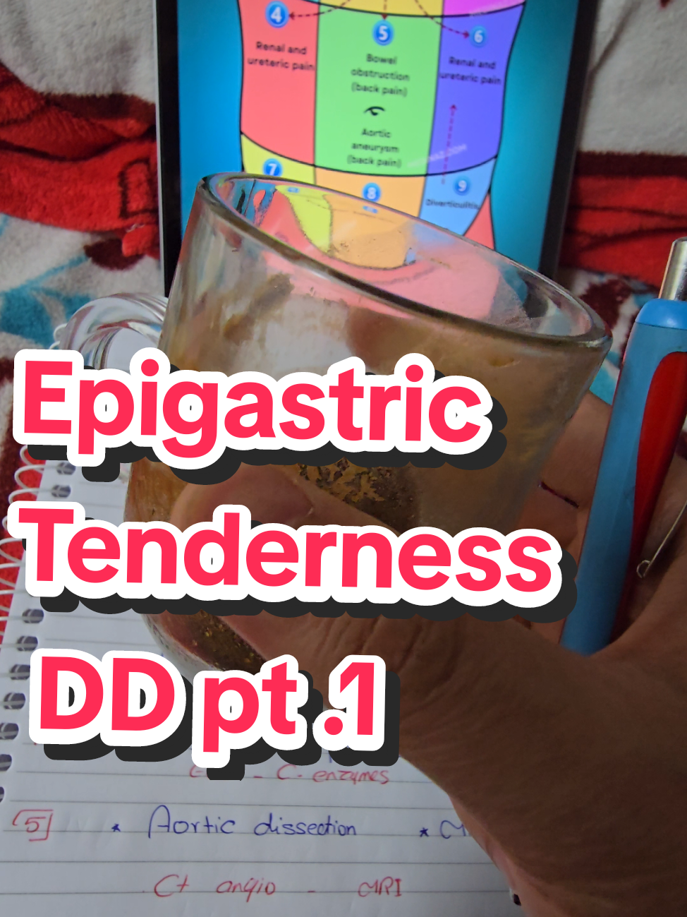 Epigastric tenderness DD pt.1 #medicalstudent #تمريض #طب #امتياز_طب #medecine #medicalfield #epigastricpain 