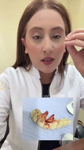 فشل في تركيبات الاسنان …اتقوا الله في شغلكوا 🙏🏻 #تركيبات_الاسنان #تجميل_الاسنان #تعويض #تعويض_اسنان #تعويض_اسنان_مفقودة🦷♥️🥀 #علاج_الاسنان_في_مصر #تجميل_الاسنان_مصر #